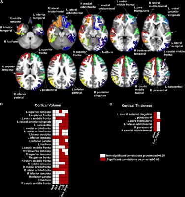 Brain cortical alterations in COVID-19 patients with neurological symptoms
